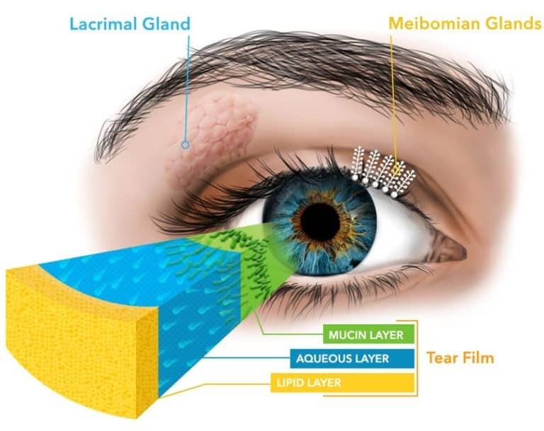 Top 21 Causes and Treatments for Dry Eye Syndrome (a helpful ...