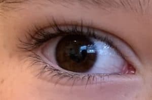 my daughters eye